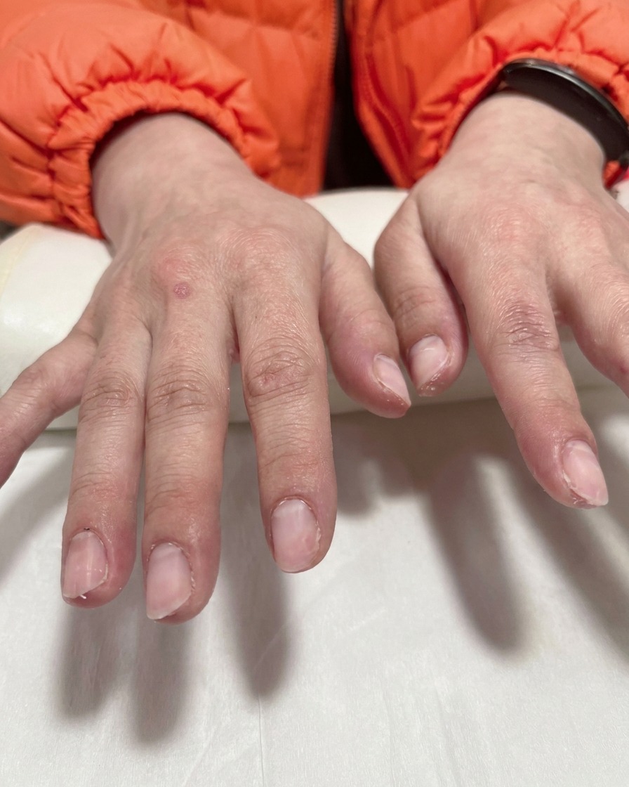 A close-up of an airbrush tool spraying a fine white mist onto the tips of nails covered by purple stencils.