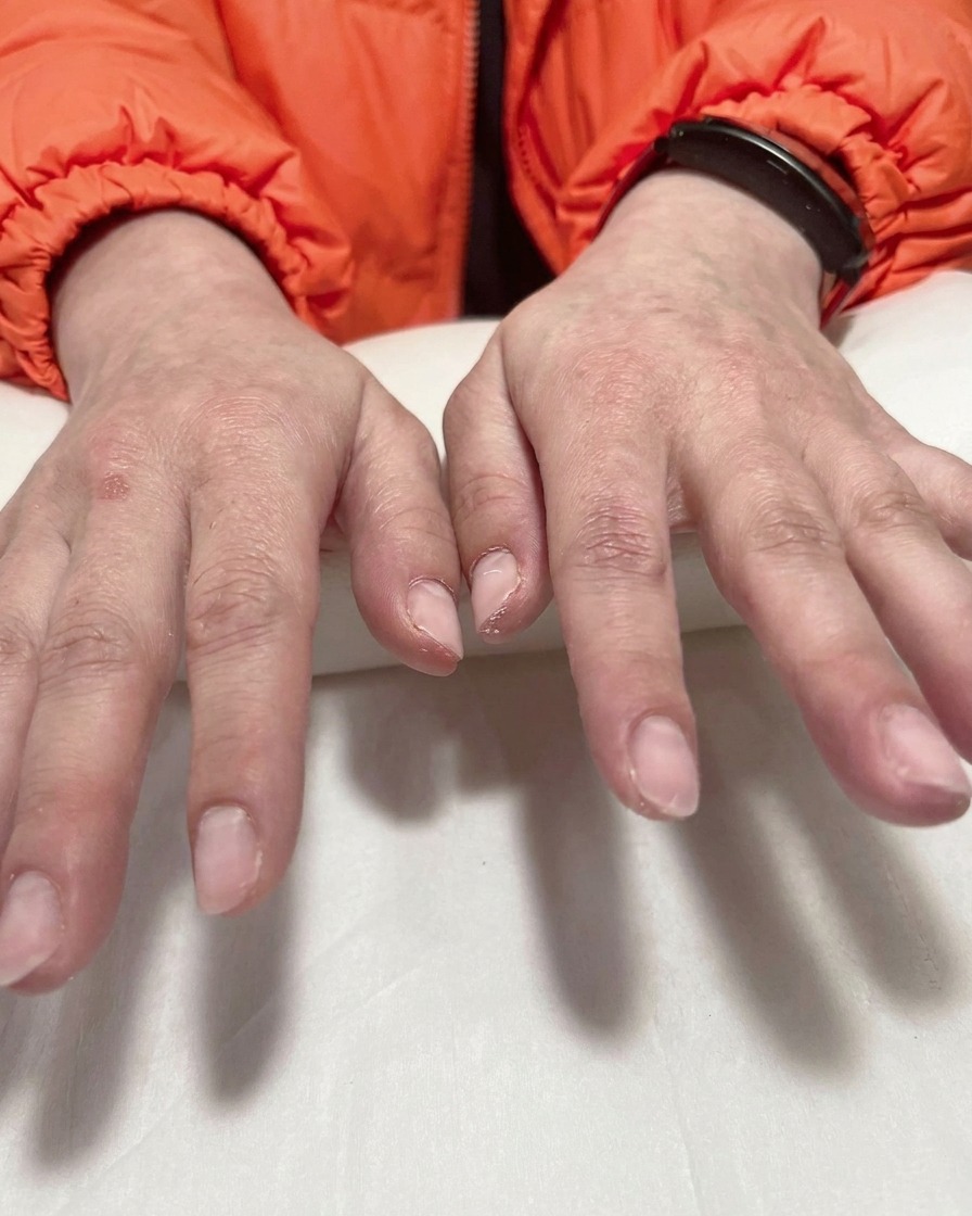 A close-up of a hand with tweezers carefully removing a purple stencil from a nail, revealing a crisp white ombre tip.