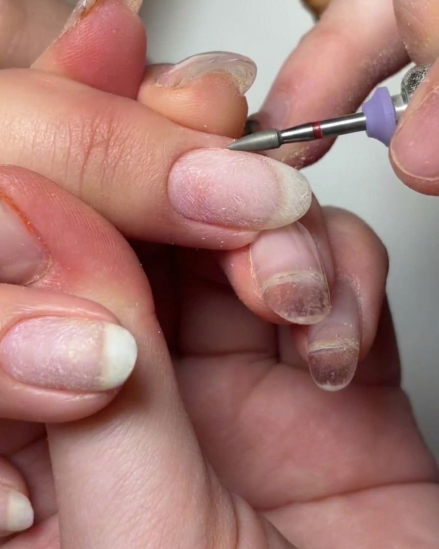 A cone-shaped drill bit being used to clean around the cuticle area with alcohol.