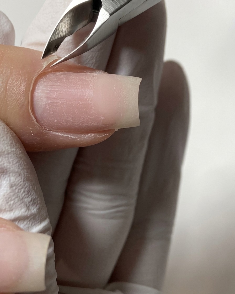 A close-up of metal cuticle nippers accurately trimming lifted dead skin around the proximal nail fold.