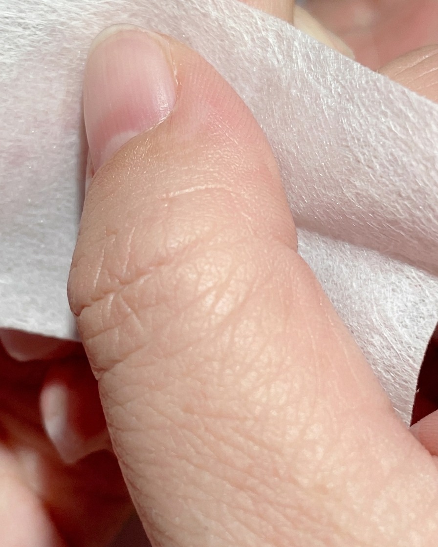 A nail wipe soaked in cleansing liquid cleaning the surface of the nail.
